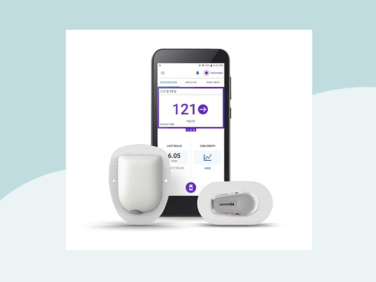 Omnipod 5: First Tubeless Automated Insulin Delivery System