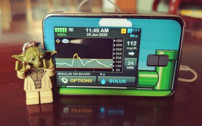 Product Review: Tandem Diabetes Control-IQ